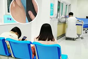 光疗后白斑变黑
