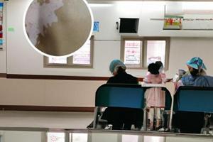 白癜风可以光疗治疗吗是真的吗