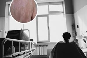 贵州白癜风皮肤病是什么样医院