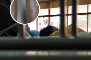 贵州治疗白癜风价格