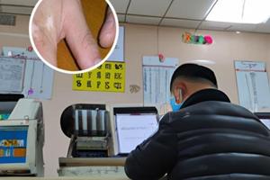 黔西南市治疗白癜风专科医院