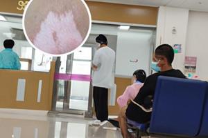 贵州白斑病医院在哪