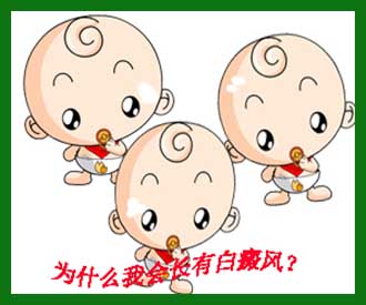 婴儿白癜风有什么症状 白斑造成的危害很大么