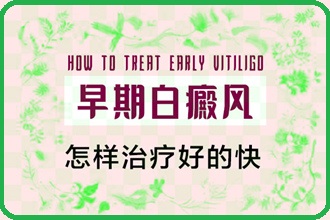 颈部白癞风要治疗，这4点你要知道一下!