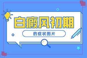 白颠疯是怎么治疗[如何治疗成效好]治疗儿童白斑需要多少钱