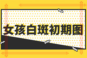 白癜风进行哪些暴露部位术，才可以恢复到正常色泽