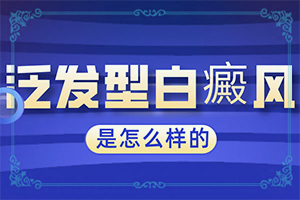 白癫风该如何治疗,患者白殿疯能治的好么