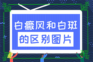 白殿疯如何掌控,有暴露部位中的长白如何治疗