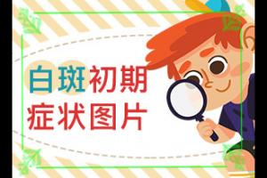 患白点癫风能治的好,白殿风长脸好