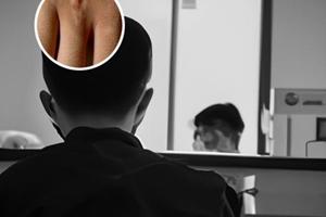 新生儿起白点周围红白点破了发红怎么办