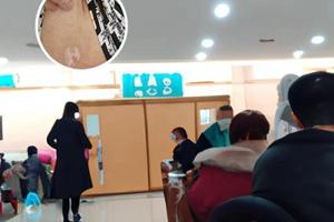 308照射白癜风会复发嘛