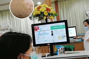 皮肤检查做皮肤镜是什么意思啊