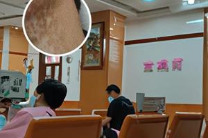 白疯癫症状用什么药较快好