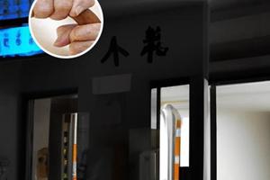白癜风的初期症状治疗