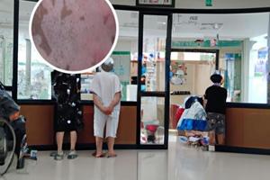 白癜风白斑能否中医拔罐
