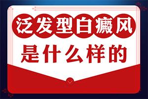 儿童白风癫治疗费用多少钱