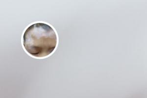 白癜风擦药发红正常吗