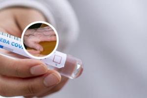 准分子激光手术多少钱
