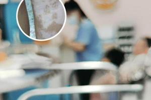 胸腺肽肠溶片是提高免疫力吗