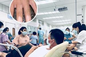 补骨脂颗粒能和罗红霉素同服吗