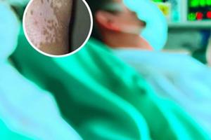 希格玛308光疗仪使用方法
