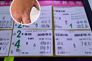 伍德灯能不能误诊
