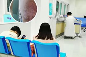 有晕痣一定会出现白癫风吗