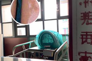 炎症后色素减退会越来越白吗