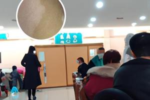 小孩脸上有淡白斑块怎么回事儿