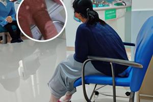 小孩脸上有白斑块的图片是什么原因造成的