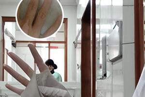 15岁女娃脸上突然长出无数色素减退斑怎么回事