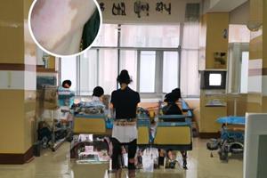 小孩患了白斑怎么办图片高清