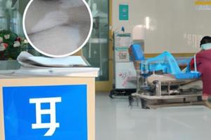 人为什么长晕痣的原因