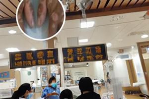 白颠疯白斑处发红