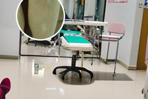 小孩脸上长白斑怎样去除图片