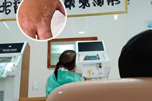 头皮白颠疯怎么治