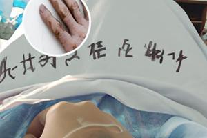 小孩脸上有白斑是缺少什么营养吗怎么治疗好