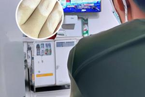 308准分子激光白癜风多长时间一次