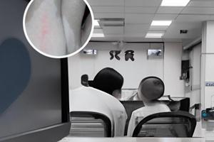 308治疗白斑多少次能好