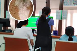 白癜风308照光后发红一般多久恢复