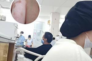 白斑照308复色步骤详解解析