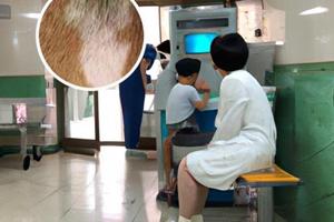 白癜风用308管用吗为什么