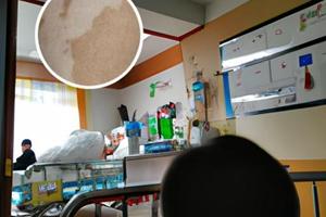 白癜风308激光一般几次见效