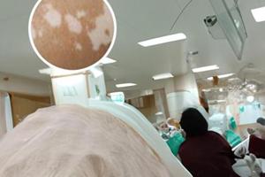 脸上的白癜风不照308光只图外用药能好吗为什么