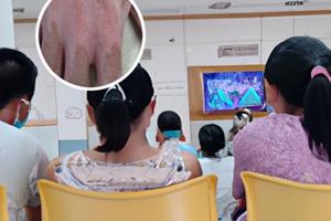 白癜风308激光治疗仪多少钱一台