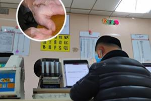 308治疗白癜风机器