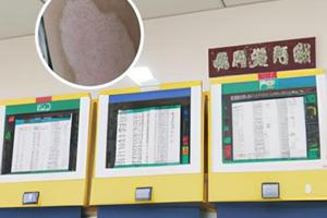 白癜风不做308能好吗为什么