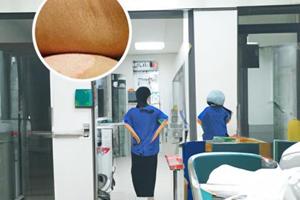 308激光治疗白癜风医保报销吗