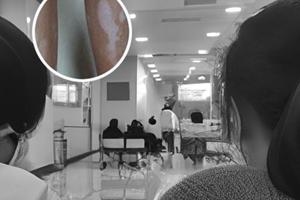家用308白斑治疗仪可以在网上买吗是真的吗