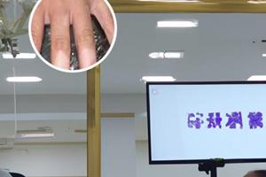 他克莫司能长期用